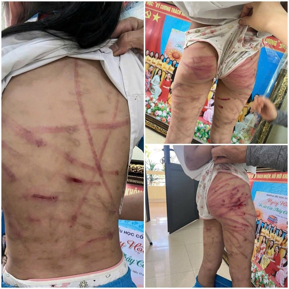 Chính thức khởi tố 'cha dượng' Nguyễn Văn Nam  - ảnh 3