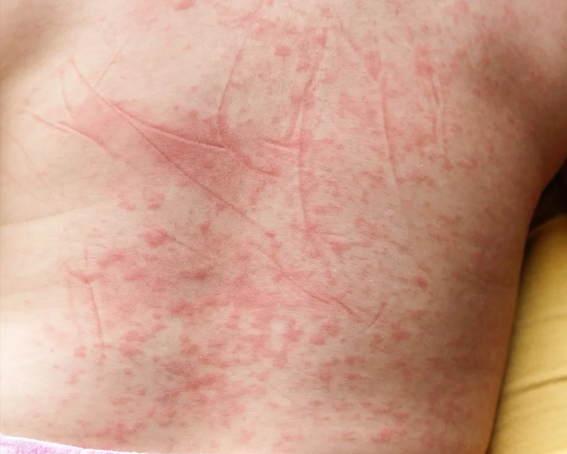 Tăng cường phòng chống sốt xuất huyết trước mùa cao điểm - ảnh 2