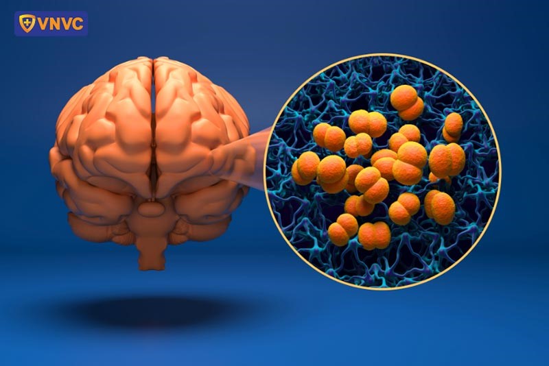 Cảnh báo quan trọng về căn bệnh cực nguy hiểm, có thể gây tử vong chỉ sau vài giờ - ảnh 1