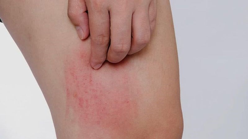 Báo động nguy cơ tổn thương gan, thậm chí dẫn đến ung thư nếu giữ thói quen ăn uống này - ảnh 2