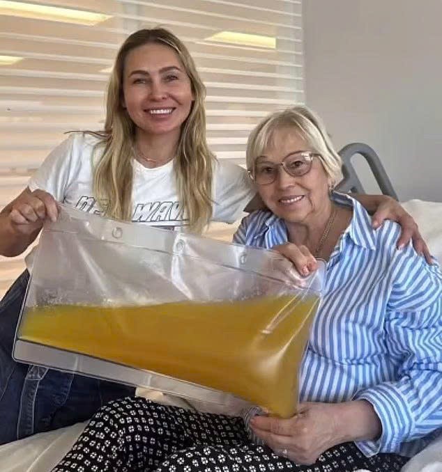 Giới siêu giàu rộ mốt ‘lọc máu’ để kéo dài tuổi thọ, giá 10.000 USD/lần - ảnh 3