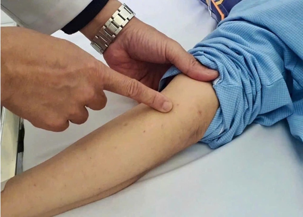 Căn bệnh tăng đáng báo động vào mùa lạnh, có thể tử vong trong 24 giờ: Dấu hiệu và cách nhận biết - ảnh 2