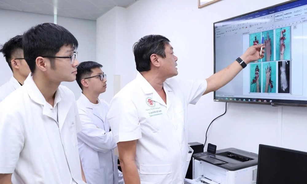 Thiếu niên 15 tuổi dập nát bàn tay vì pháo tự chế - ảnh 1