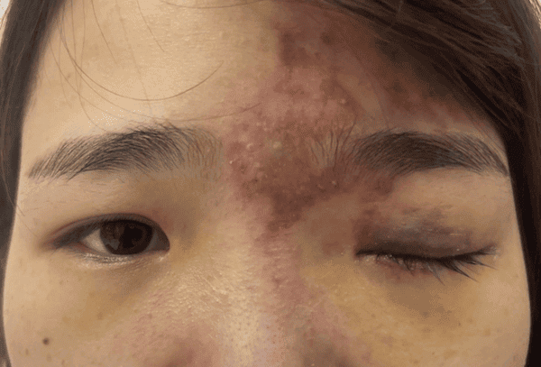 Nhiều người hỏng mặt sát Tết vì làm đẹp 'siêu tốc', chuyên gia y tế khuyến cáo - ảnh 1