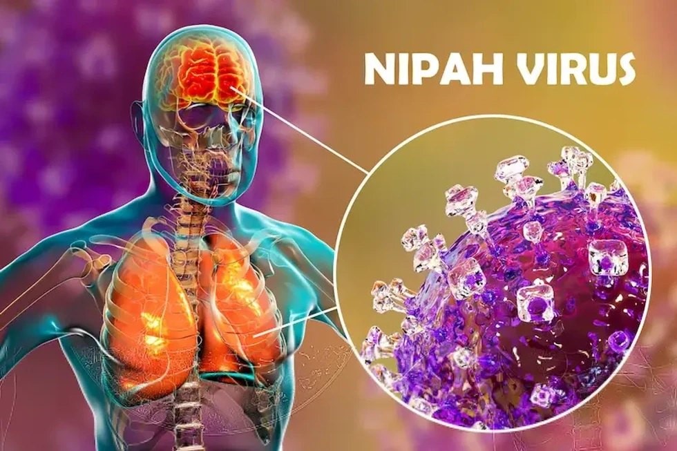 Tin vui: Trung Quốc tìm ra thuốc phòng chống virus Nipah hiệu quả - ảnh 3