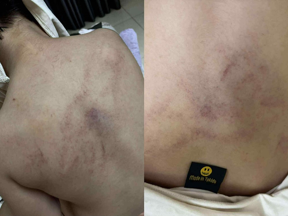 Tạm đình chỉ cô giáo mầm non đánh đập, kéo lê, ném bé gái 4 tuổi vào tường - ảnh 1