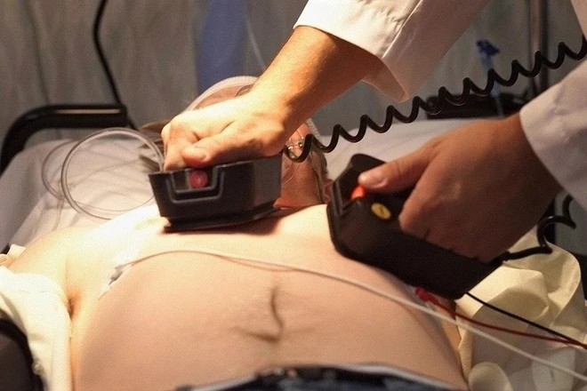 Tin vui: Việt Nam chính thức thí điểm đặt máy sốc tim ở nơi công cộng - ảnh 2