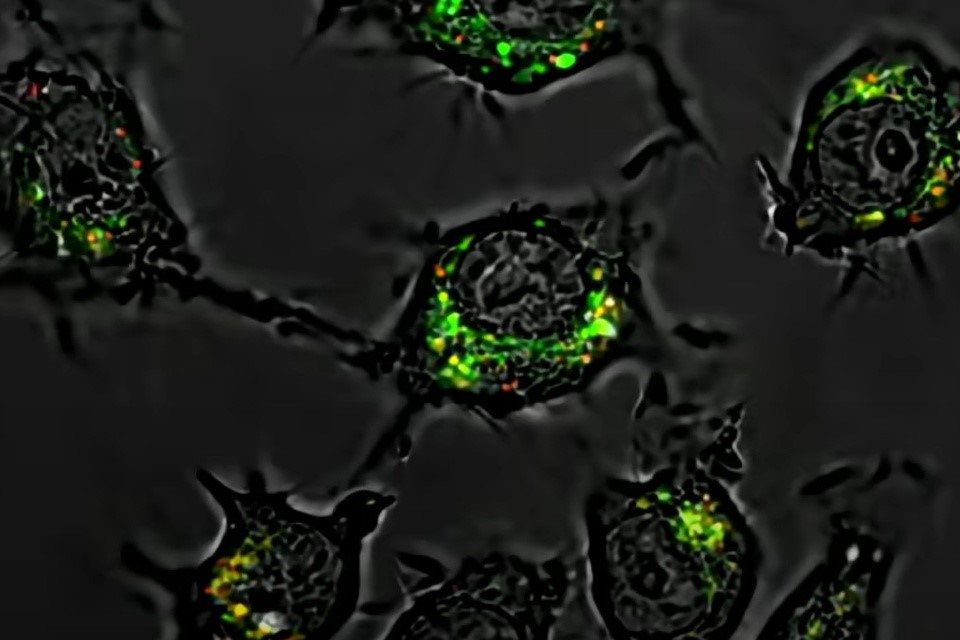 Phát hiện thuốc mới tiêu diệt tế bào ung thư mạnh gấp 20.000 lần, không gây tác dụng phụ - ảnh 1