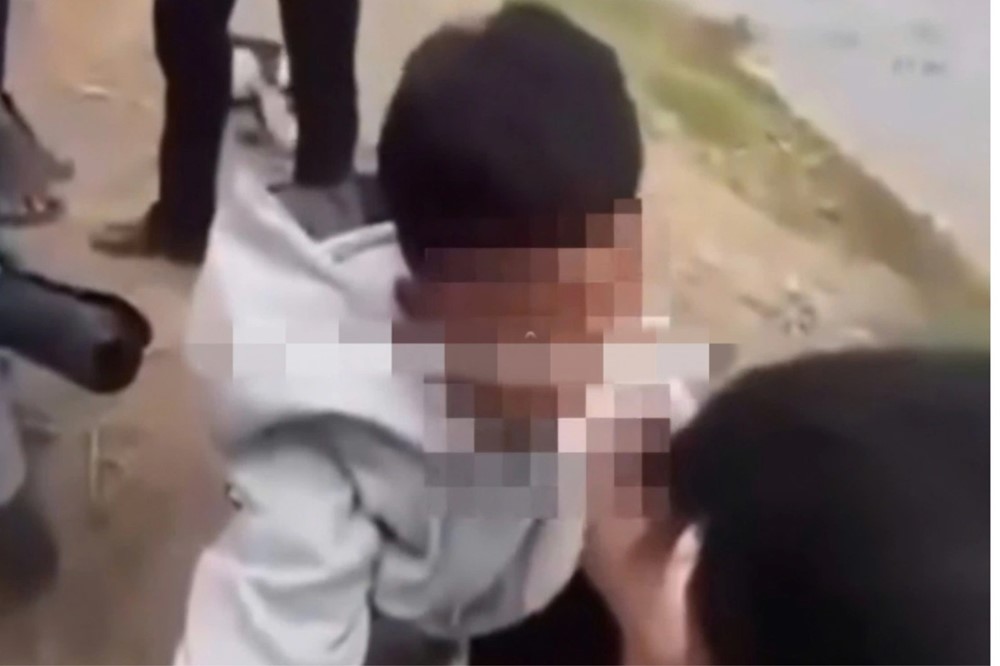 Sở Giáo dục chỉ đạo làm rõ vụ nam sinh lớp 10 bị nhét băng vệ sinh vào miệng - ảnh 1