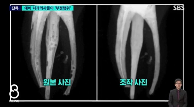 34 sinh viên khoa Răng Hàm Mặt dùng Photoshop để chỉnh sửa phim X-quang - ảnh 1