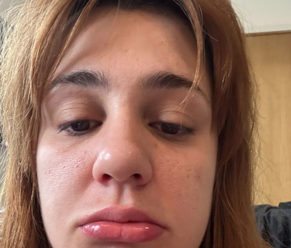 Cảnh báo mỹ phẩm giả nguồn gốc Trung Quốc tràn lan trên sàn thương mại điện tử, có thể gây dị ứng thậm chí bỏng nặng - ảnh 2