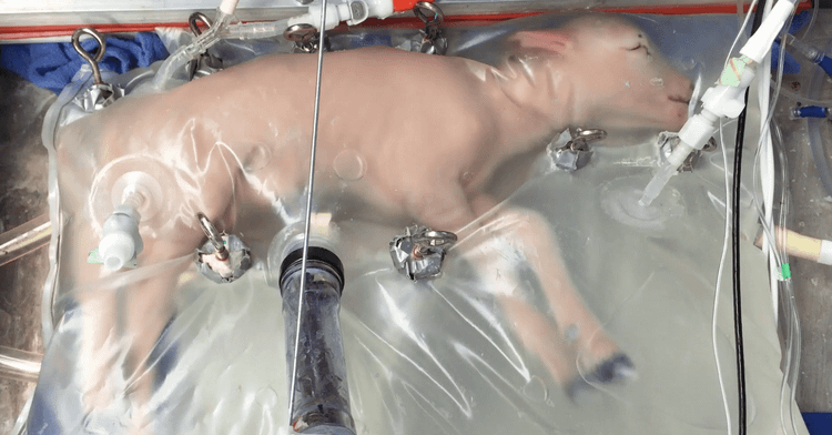 Robot mang thai hộ giá hơn 367 triệu đồng gây nhiều tranh cãi - ảnh 3