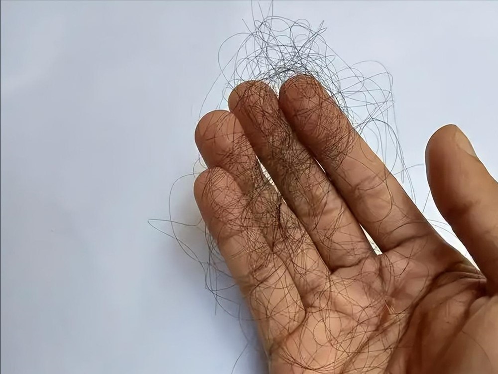 Đàn ông có thể sống thọ bao lâu chỉ cần nhìn mái tóc là biết? Cảnh báo nếu xuất hiện 3 dấu hiệu này, cần đặc biệt chú ý! - ảnh 2