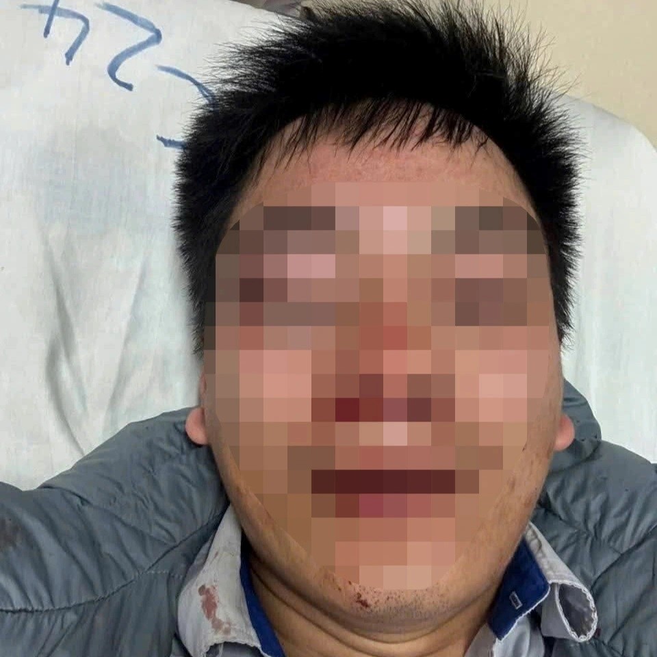 Công an vào cuộc vụ tài xế xe buýt bị nam thanh niên hành hung trên xe - ảnh 1