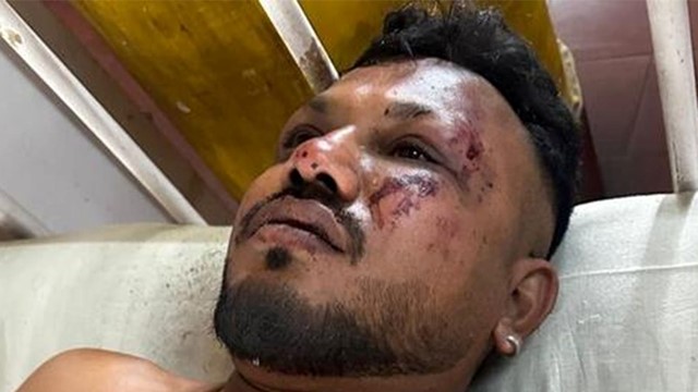 Bí ẩn trong tai nạn máy bay kinh hoàng khiến hơn 200 người thiệt mạng: Vì sao người ngồi ghế 11A lại sống sót?