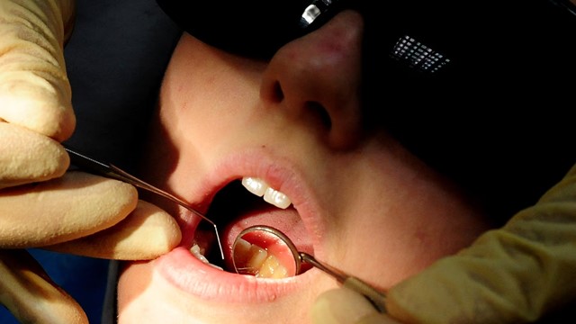 Bắt giữ, điều tra ‘bác sĩ nha khoa’ 22 tuổi cùng bố mẹ mở phòng khám trái phép