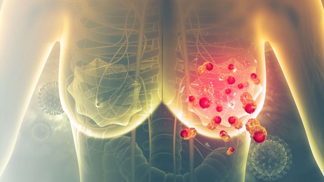 Trí tuệ nhân tạo chẩn đoán ung thư chính xác đến 99%, giúp phát hiện bệnh sớm và giảm chi phí điều trị