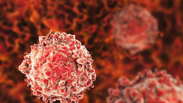 Việt Nam có hơn 180.000 người mắc ung thư mỗi năm, tăng gấp đôi sau một thập kỷ