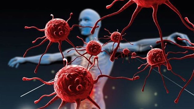 Việt Nam có hơn 180.000 ca ung thư mới mỗi năm, ung thư tuyến giáp chiếm tỷ lệ cao nhất 