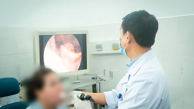 Người phụ nữ 52 tuổi suýt chết vì chữa hóc xương cá theo mẹo dân gian