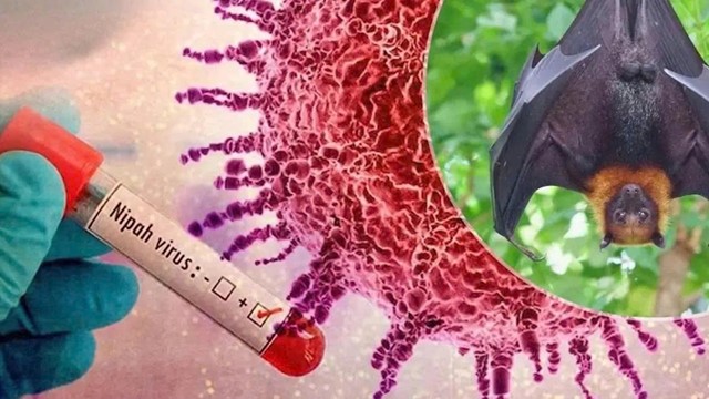 5 lý do khiến WHO xếp Nipah vào nhóm mầm bệnh nguy hiểm nhất thế giới