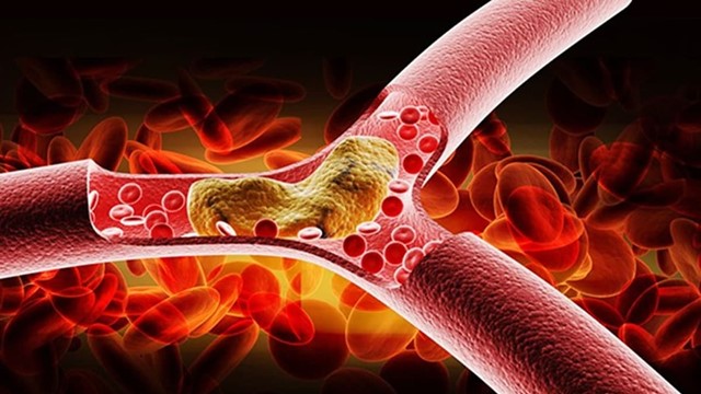 6 loại gia vị quen thuộc tốt cho sức khỏe, giảm mỡ máu, được chuyên gia khuyên dùng