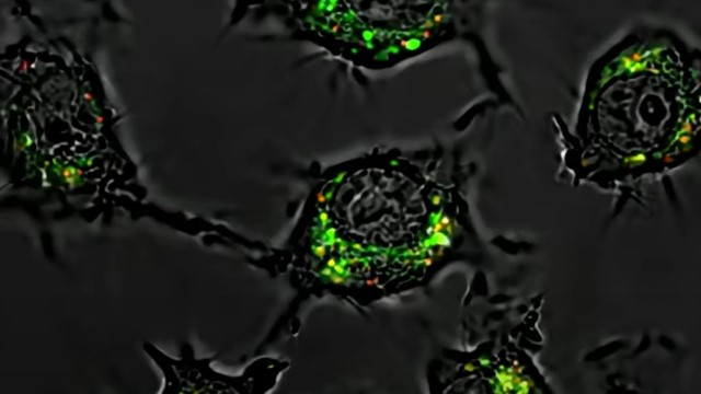 Phát hiện thuốc mới tiêu diệt tế bào ung thư mạnh gấp 20.000 lần, không gây tác dụng phụ