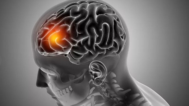 Phát triển thuốc điều trị ung thư dạng nhỏ mũi