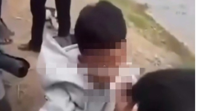 Sở Giáo dục chỉ đạo làm rõ vụ nam sinh lớp 10 bị nhét băng vệ sinh vào miệng