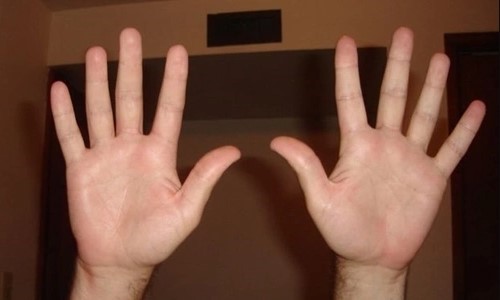 Hé lộ lý do con người có 5 ngón tay, ngón chân mà không phải 6 hay 7 ngón