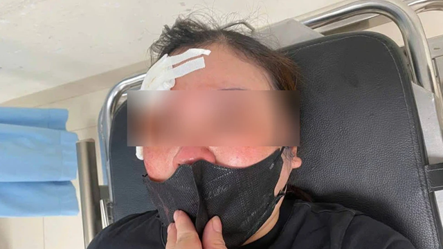 Cãi vã khi tham gia giao thông, người phụ nữ bị chọc thẳng gậy sắt vào mặt: Công an lập tức vào cuộc