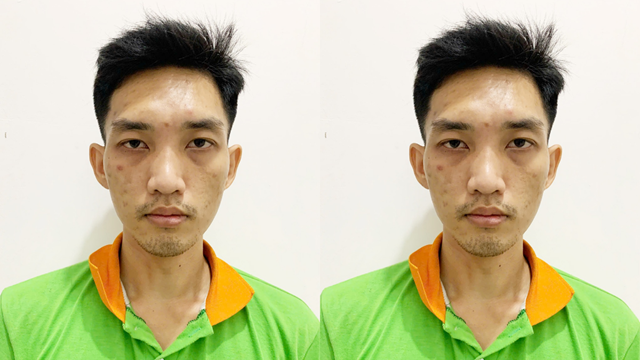 Nguyễn Quốc Thịnh, 30 tuổi bị truy nã vì trộm 17kg khô mực ra đầu thú